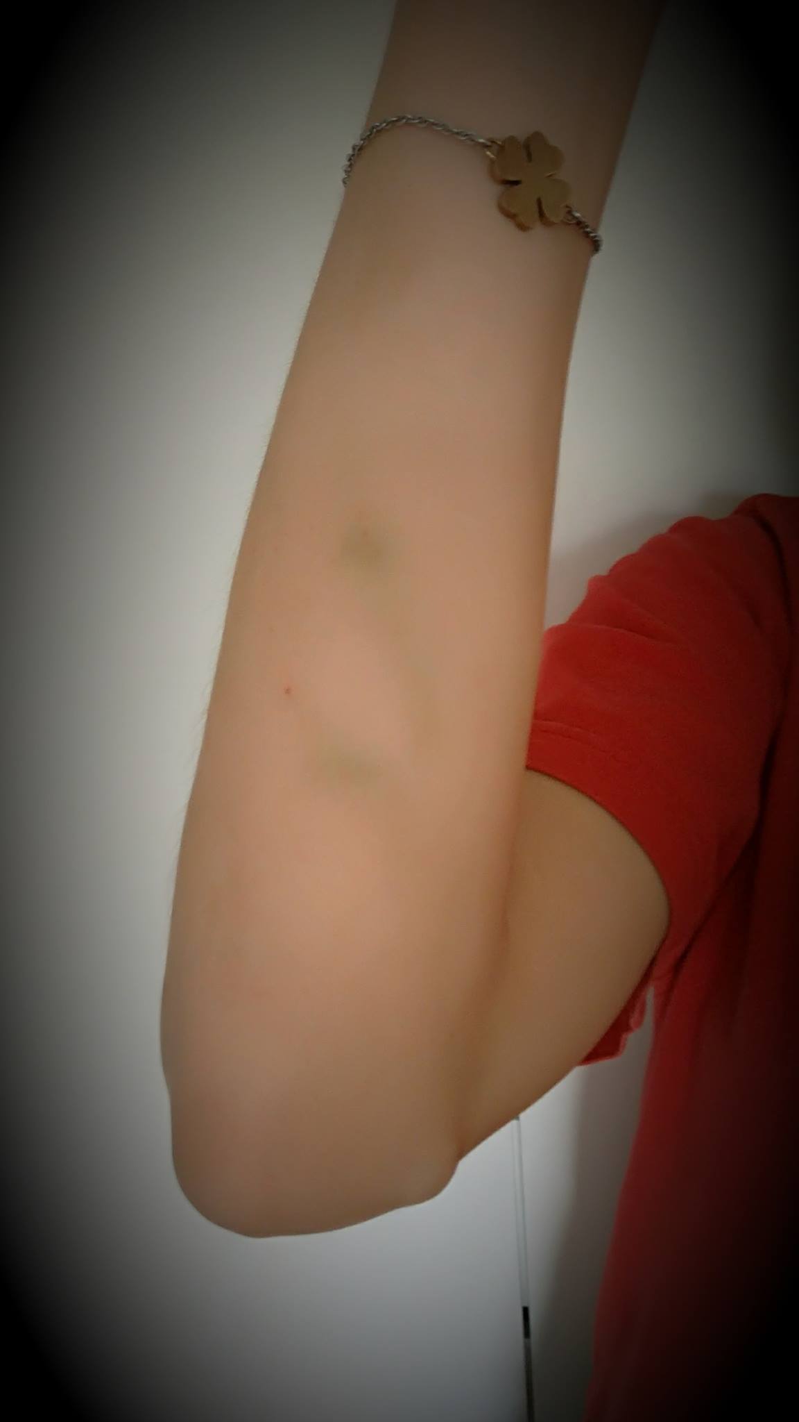 2017_09_09 Blodkärlen