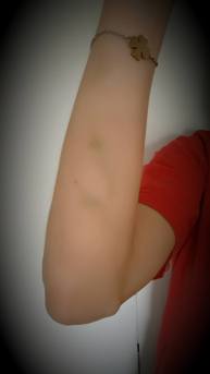 2017_09_09 Blodkärlen