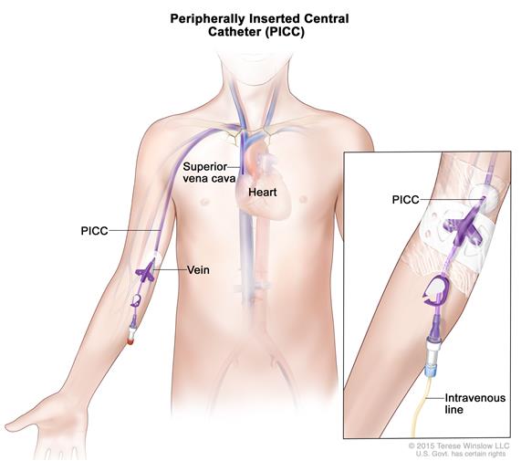 PICC-line