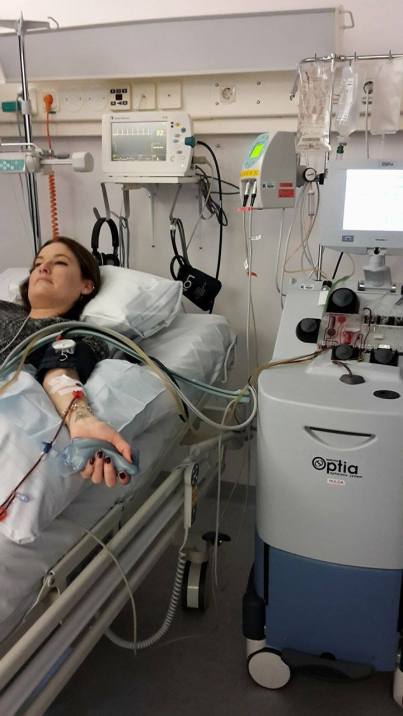 170329 Fotoferes behandling #4