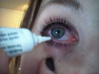 #2 170302 Ögondroppande