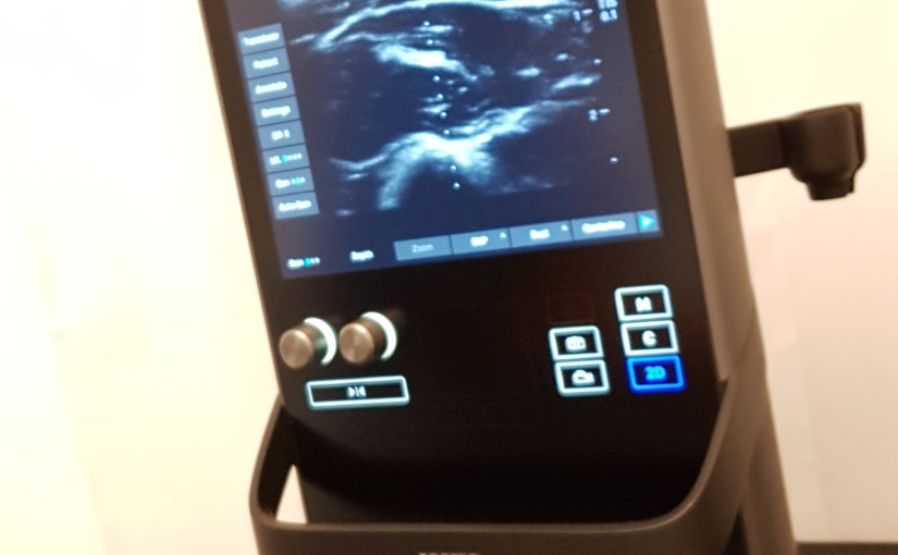 Inte det ultraljud jag hade&nbsp;önskat
