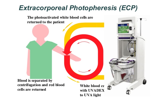 Plötslig ändring av dagens&nbsp;behandling.