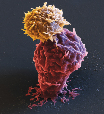 Intervjuad om min historia och&nbsp;CAR-T